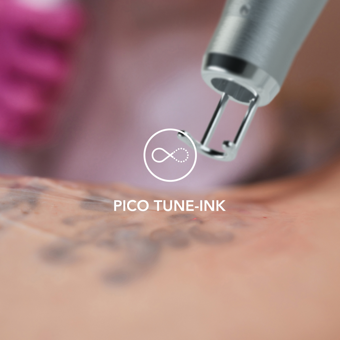 PICO TUNE – INK