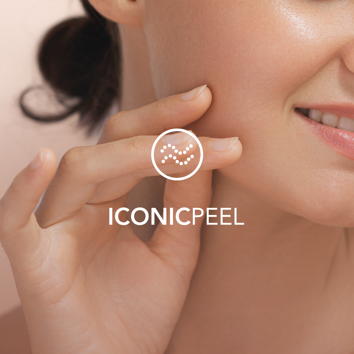 IconicPeel